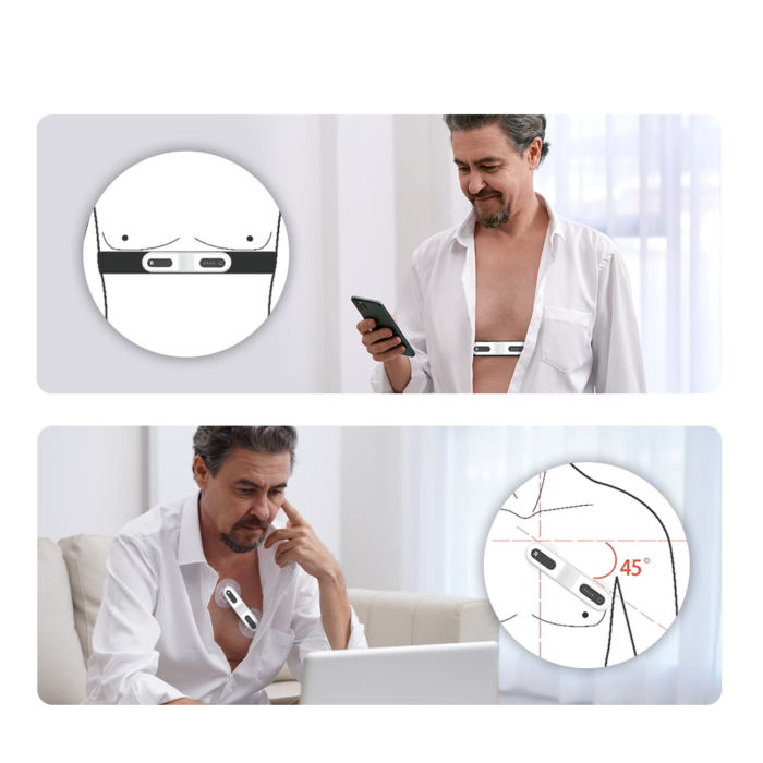 Viatom TH12 12 elvezetéses 24 órás mini EKG holter monitor - Image 10